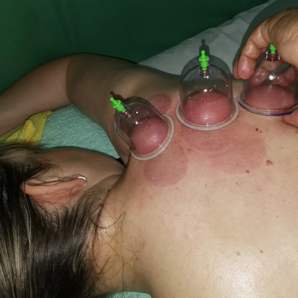 Fizikalna terapija Vranje